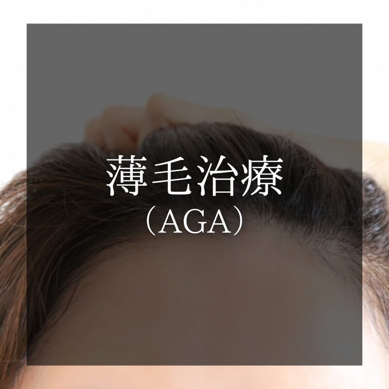 薄毛治療（AGA）